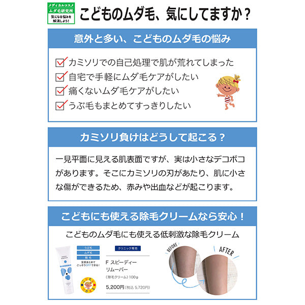 メディーナ Ｆスピーディーリムーバー